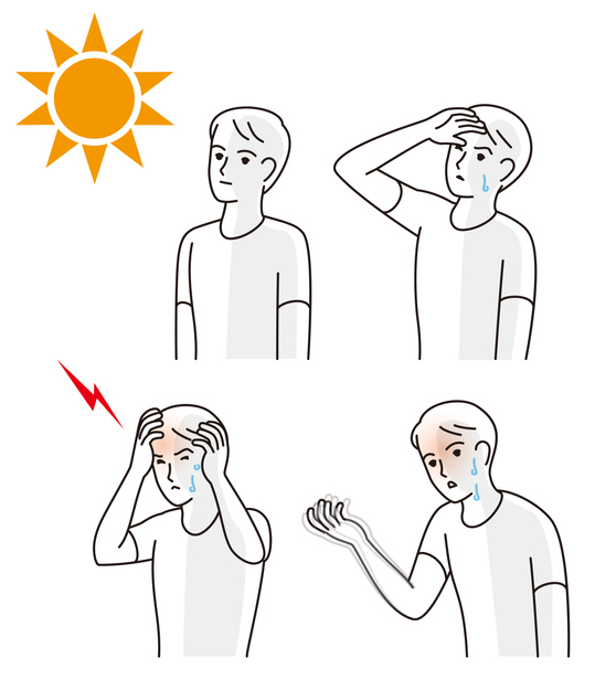 여름철 나타나는 온열질환 증상은 뇌졸중의 전조증상 '미니 뇌졸중' 증상과 유사해 각별한 주의가 요구된다, 사진제공: 게티이미지뱅크