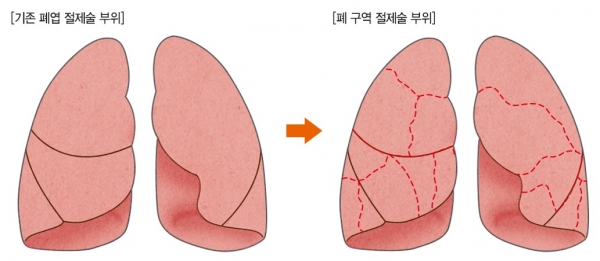 (사진출처) : 강동경희대병원