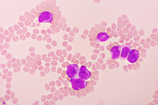 백혈구 세포 (사진출처 게티이미지코리아)