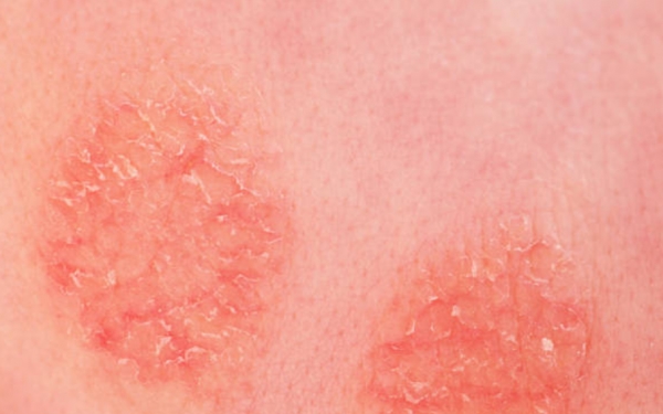 (사진출처) : istockphoto.com